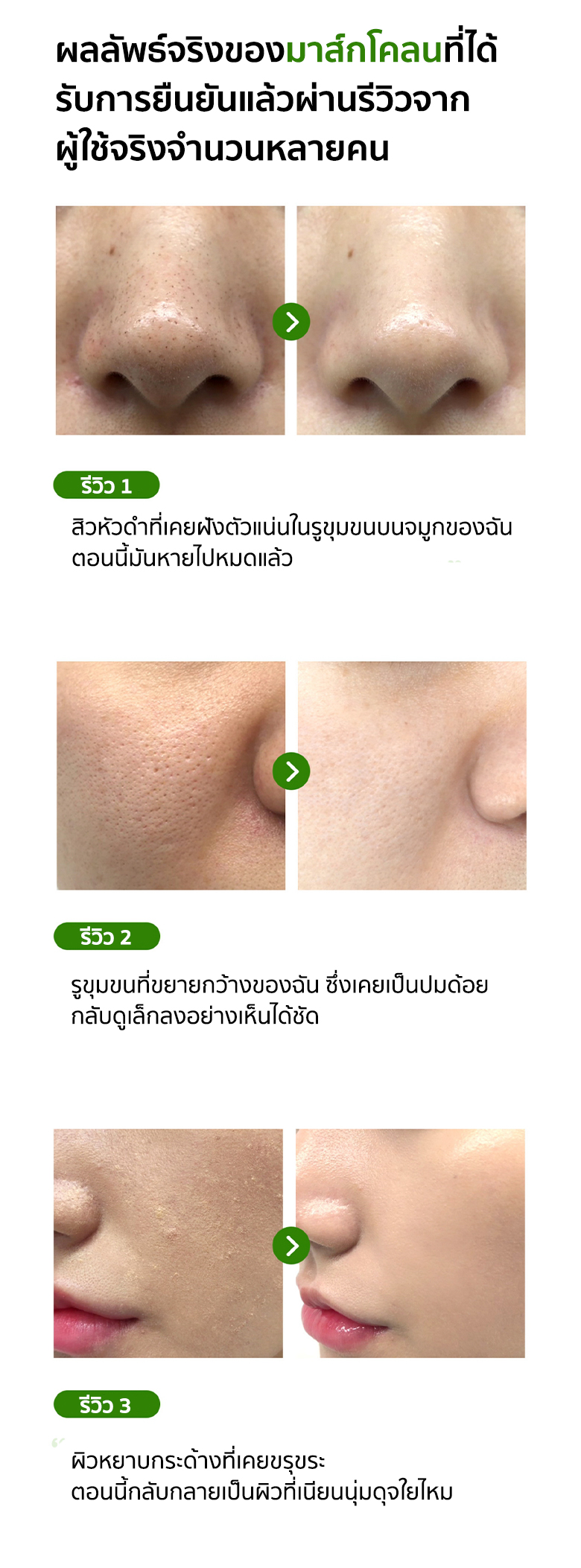 Some By Mi Super Matcha Pore Clean Clay Mask 100 g  กำจัดทุกปัญหารูขุมขน ด้วยซุปเปอร์ทมัทฉะโคลน ขจัดความมัน ขจัดสิ่งสกปรกตกค้าง กำจัดสิวเสี้ยน สิวอุดตัน ให้รูขุมขนกระชับ